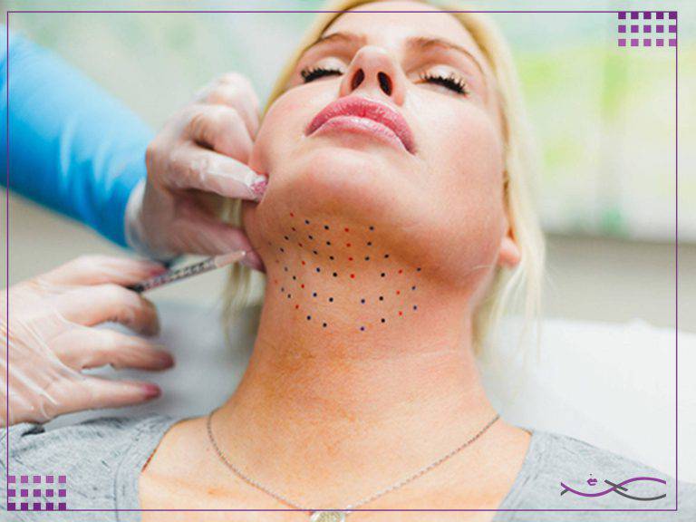 مزوتراپی غبغب: مزایا، عوارض و مراقبتهای بعد از تزریق 2 دلایل و روش درمان غبغب با مزوتراپی