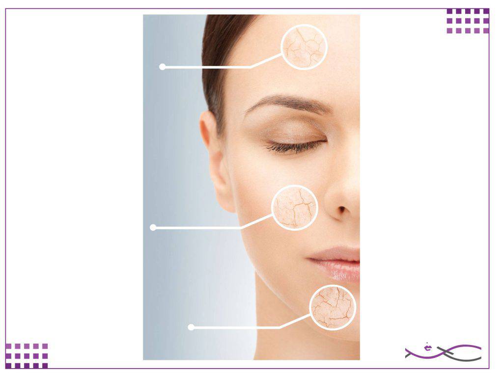 هزینه آر اف فرکشنال