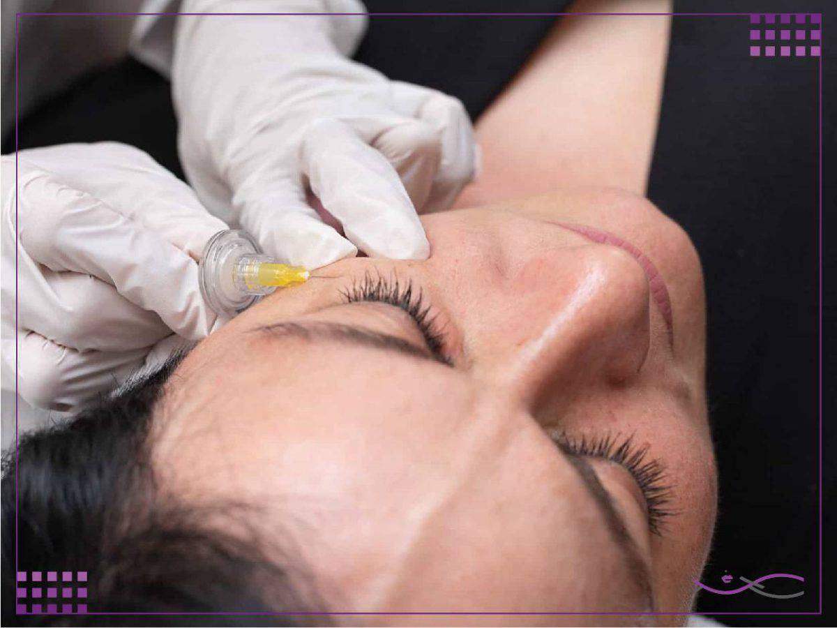 کربوکسی تراپی