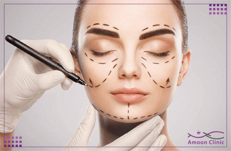 زاویه سازی صورت |مادلینگ صورت، هزینه+تصاویر 7 مادلینگ و زاویه سازی صورت