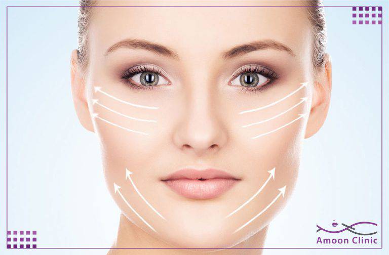 ژل گونه (فیلر گونه)؛ هزینه، عوارض و ماندگاری 3 تزریق ژل گونه یا گونه گذاری
