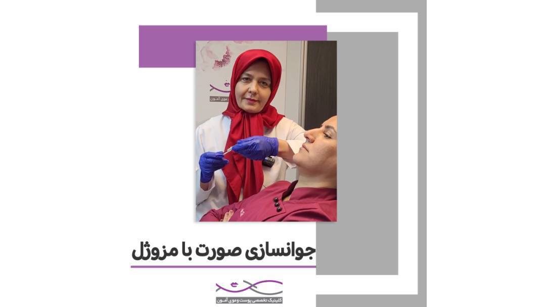 تزریق مزوژل توسط دکتر پروین متوسلین در کلینیک آمون
