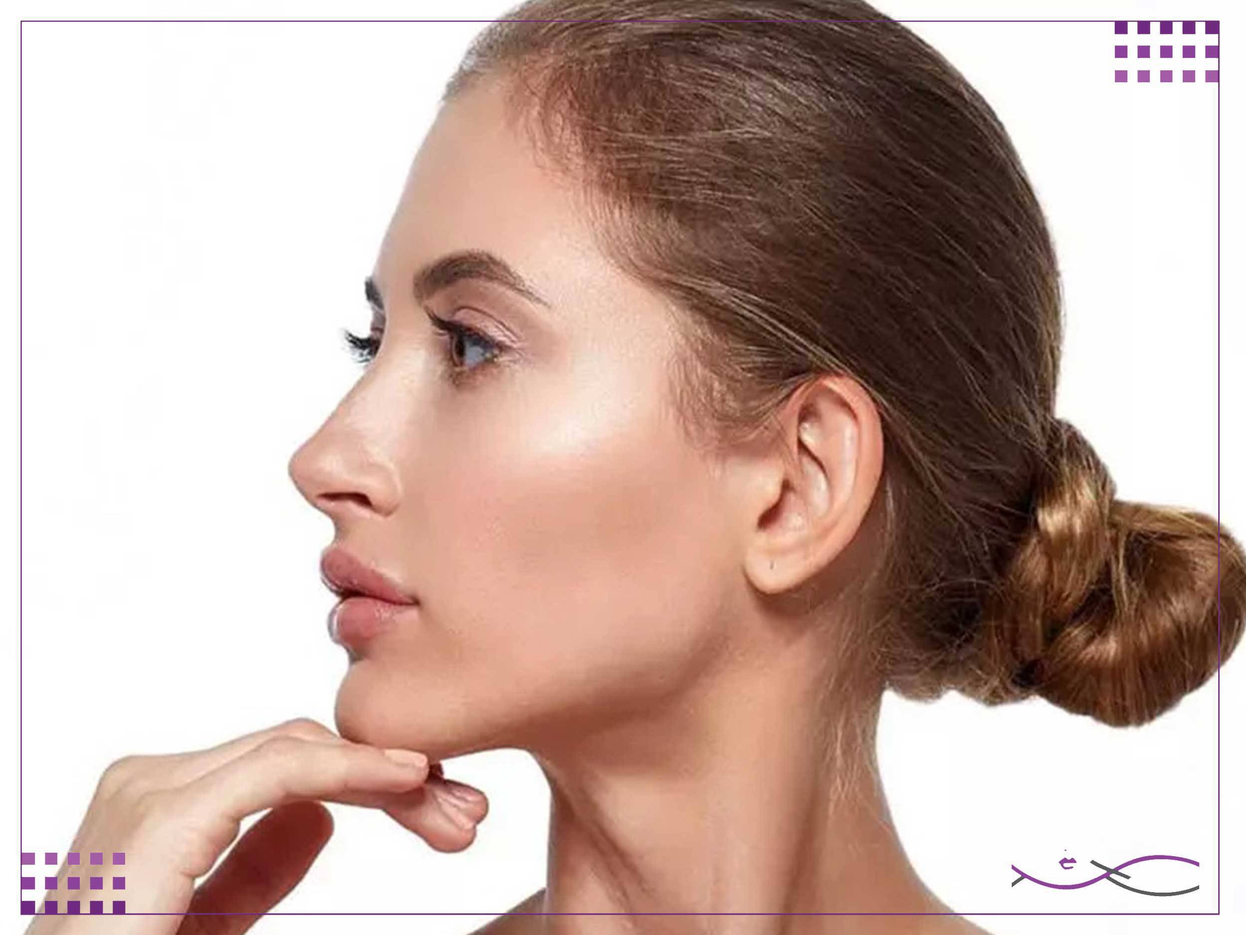 مراقبت بعد از زاویه سازی صورت