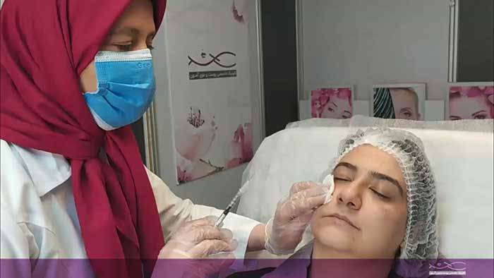 مزوتراپی صورت؛ کاربردها، عوارض و تعداد جلسات 2 مزوتراپی صورت دکتر متوسلین