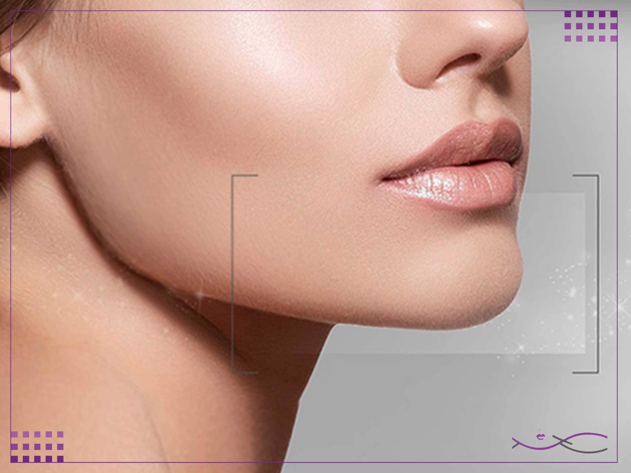 عوارض زاویه سازی صورت