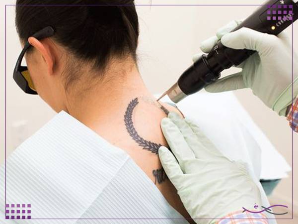 کاربردهای دستگاه کیوسوئیچ اندیگ