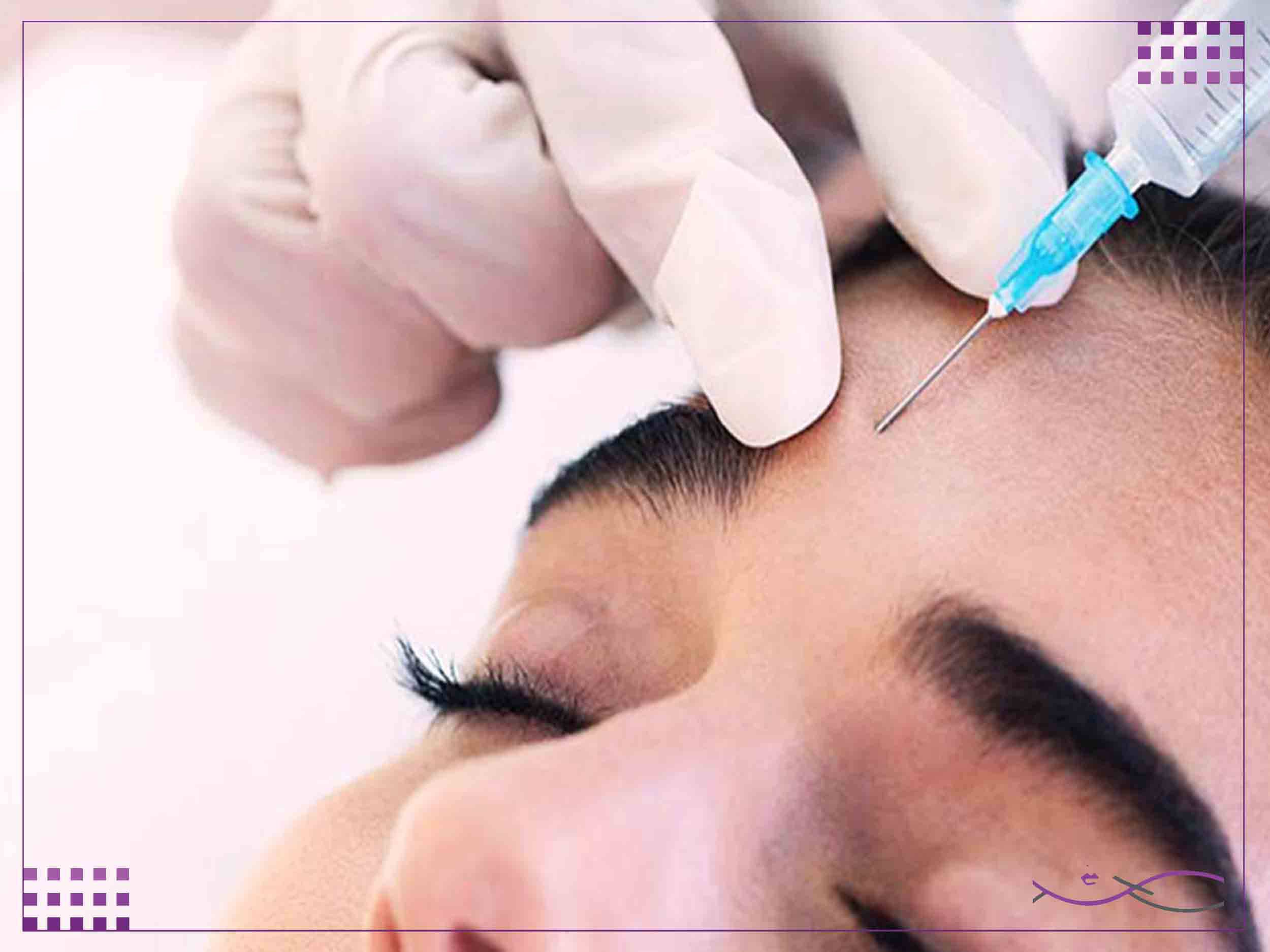تزریق بوتاکس