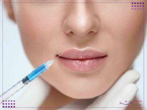 هزینه تزریق ژل لب