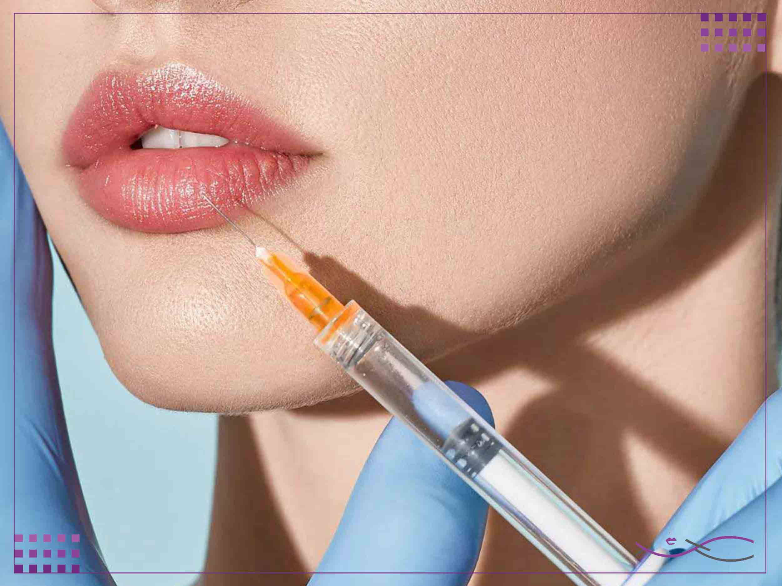 مزایای تزریق ژل لب