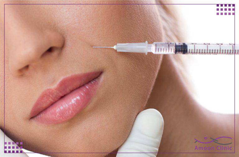 تزریق ژل خط خنده 3 اقدامات لازم قبل و بعد از تزریق ژل خط خنده