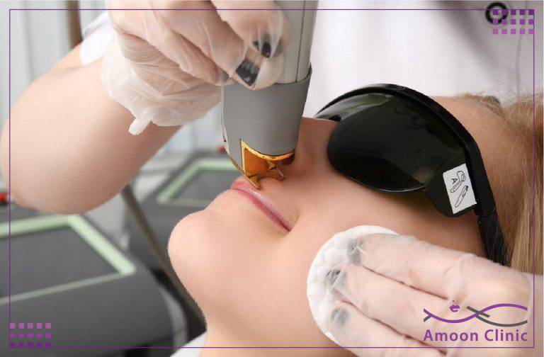 لیزر موهای زائد صورت و بدن 4 لیزر موهای زائد ناحیه زیر بغل با هندپیس دستگاه