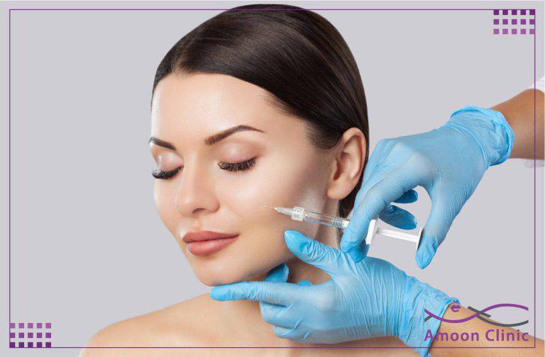 تزریق ژل خط خنده 4 تزریق ژل خط خنده با سرنگ در کنار بینی و دهان