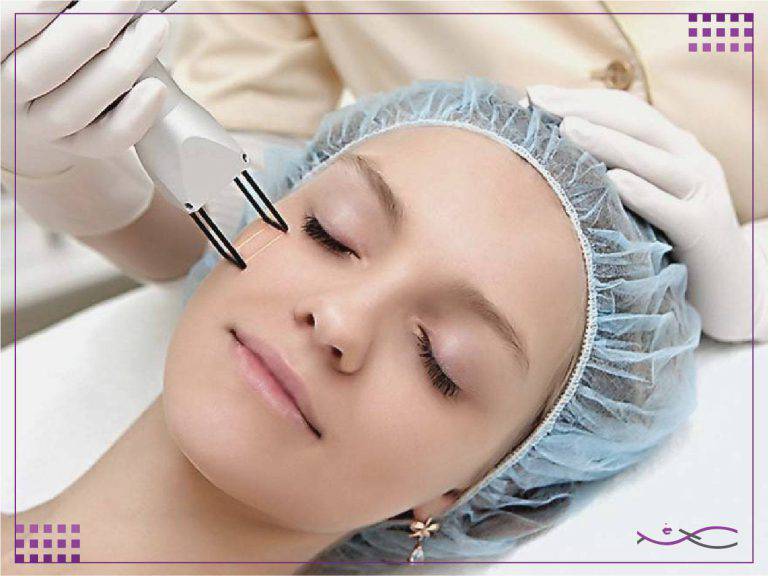 یولیزر چیست | جوانسازی پوست با یولیزر | کاربردها و مزایا 6 یولیزر