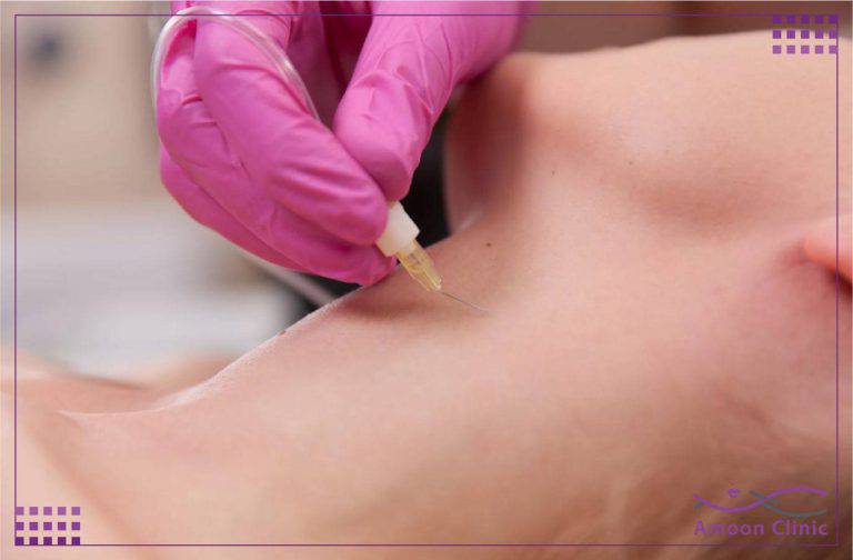 کربوکسی تراپی چیست؟