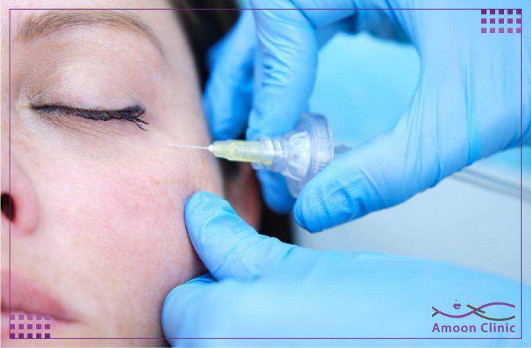 کربوکسی تراپی 2 کربوکسی تراپی شکم