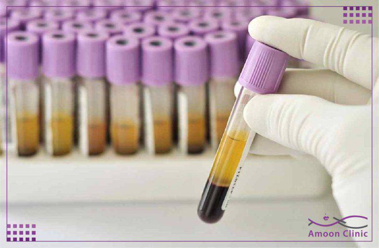 روش های جدید جوانسازی پوست 5 پی ار پی PRP