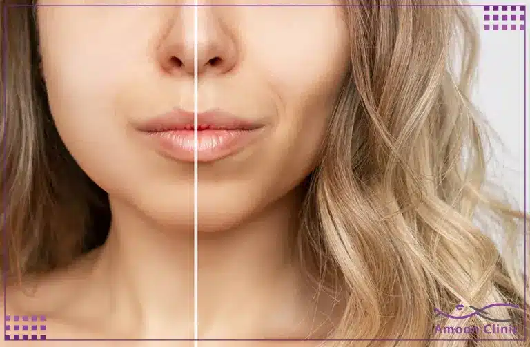 بوکال فت چیست و چه کاربردهایی دارد