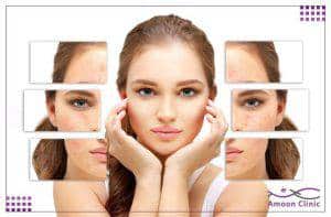 در رابطه با مزوتراپی چه میدانید؟ 7 لک صورت