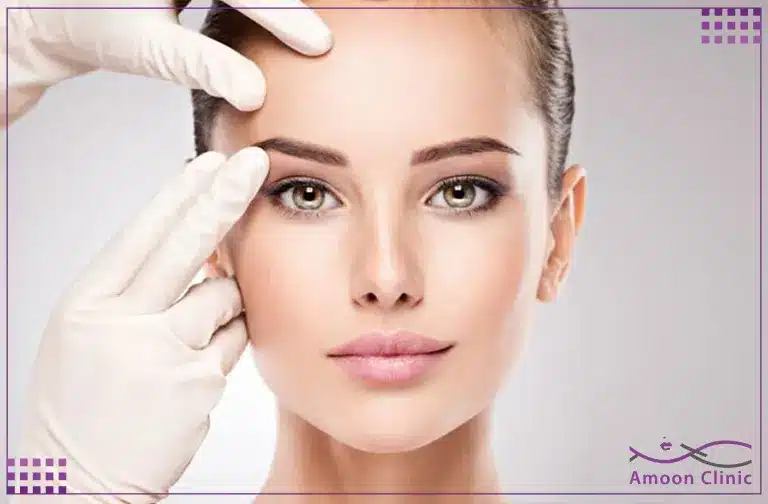 لیفت شقیقه با نخ