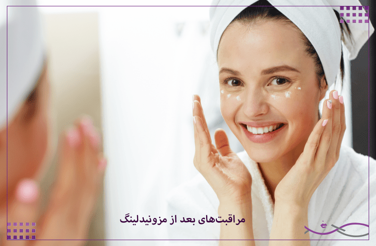 مزونیدلینگ صورت | فواید، عوارض و مراقبتها 4 مراقبتهای بعد از مزونیدلینگ