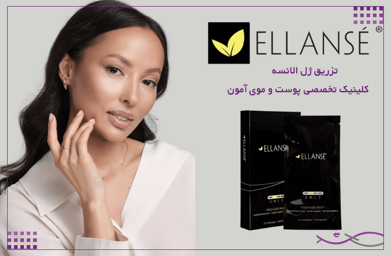 تزریق ژل الانسه