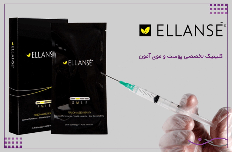 تزریق ژل الانسه: کیفیت، ماندگاری، عوارض و مزایا 1 ژل الانسه