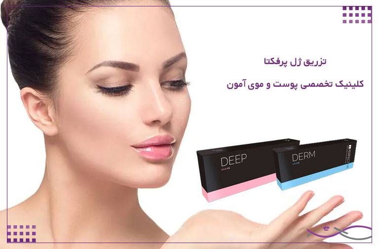 ژل پرفکتا