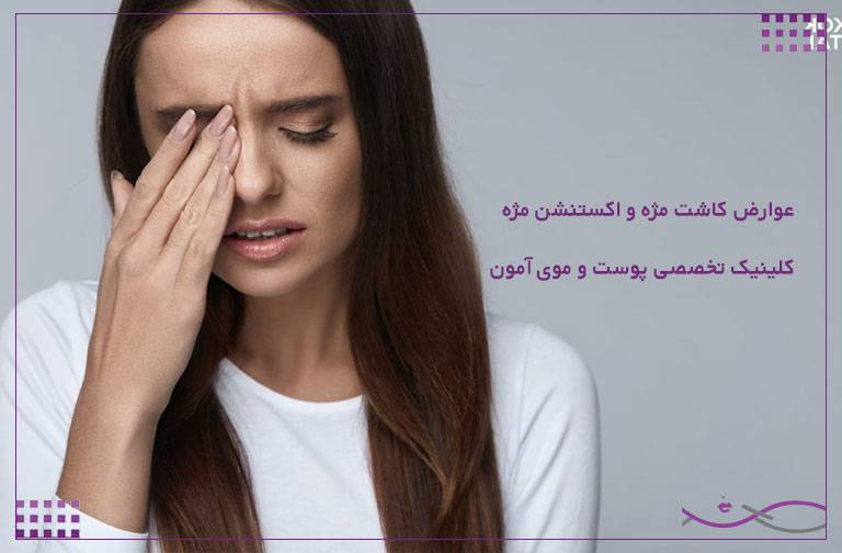 عوارض کاشت مژه و اکستنشن مژه