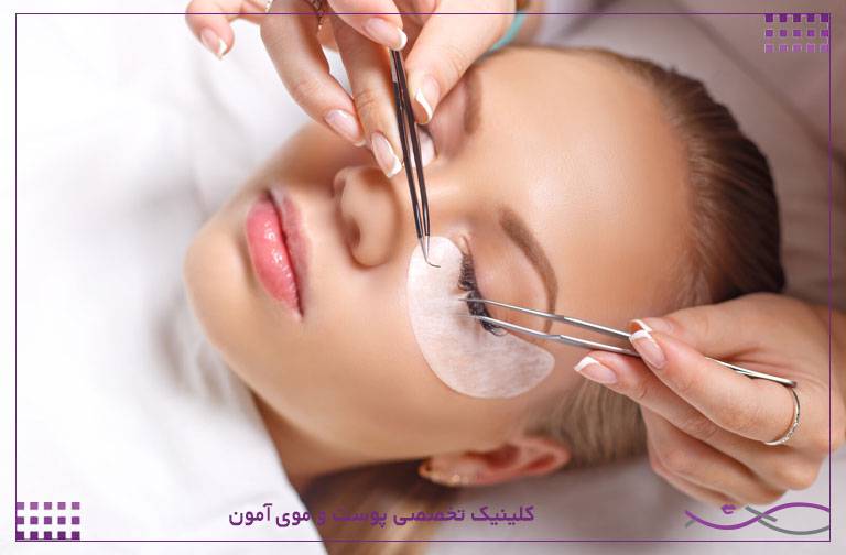 عوارض کاشت مژه و اکستنشن مژه برای چشم و پوست 1 عوارض کاشت مژه