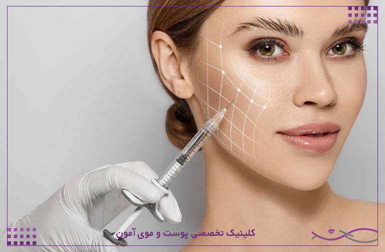 تزریق مزوژل به پوست صورت با خطوط راهنمای نواحی درمان