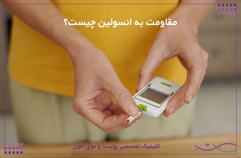 مقاومت به انسولین