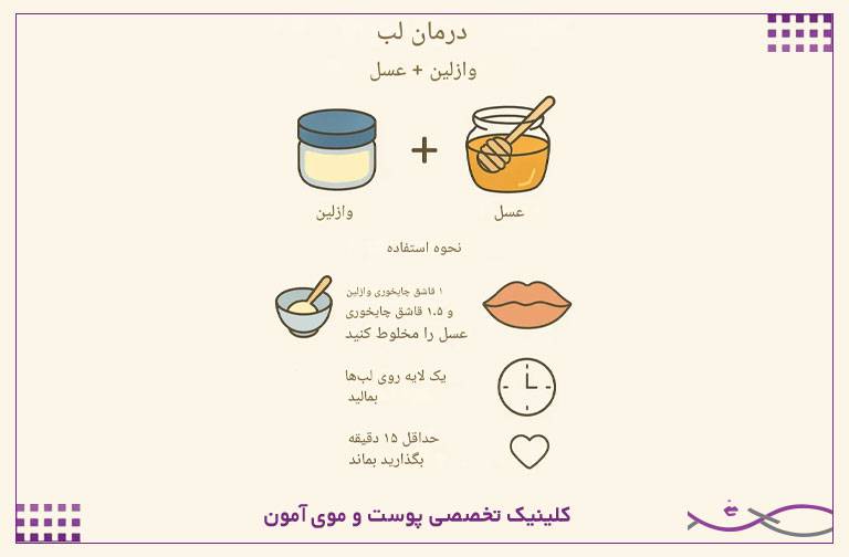 خشکی لب چیست و چگونه ترک و خشکی لبها را درمان کنیم؟ 2 وازلین و عسل