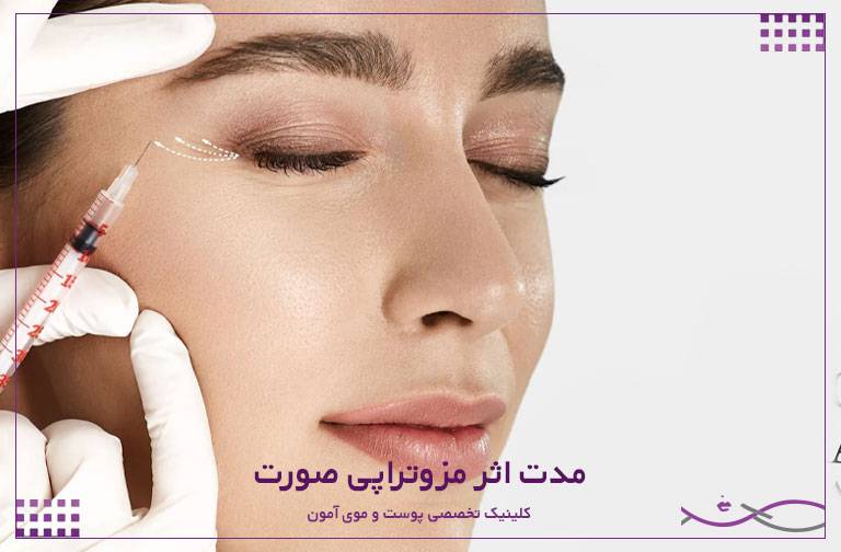 تزریق مزوتراپی صورت و بررسی مدت اثر آن