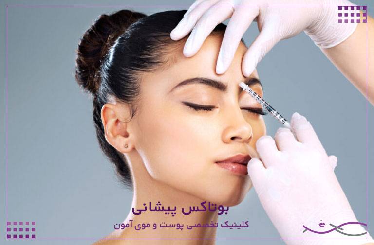بوتاکس پیشانی