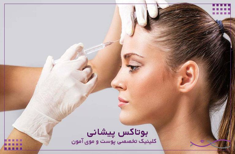 بوتاکس پیشانی