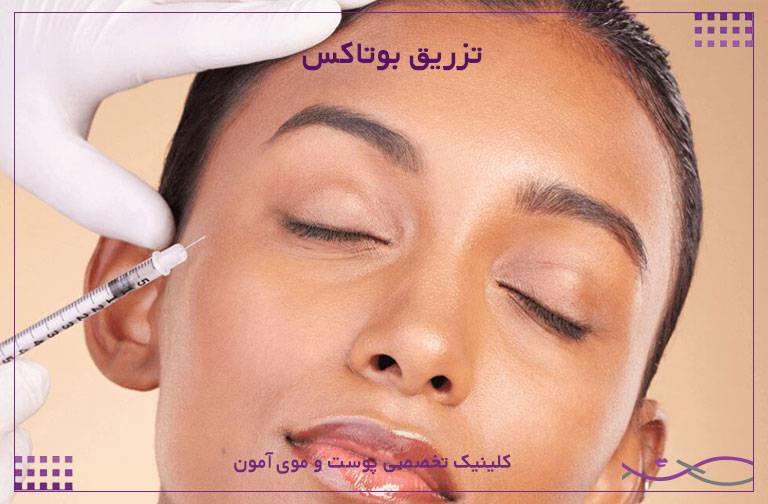 تزریق بوتاکس