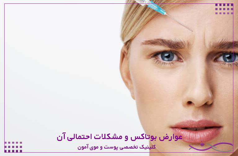 عوارض بوتاکس