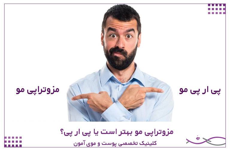 مقایسه مزوتراپی مو و پی آر پی برای درمان ریزش مو