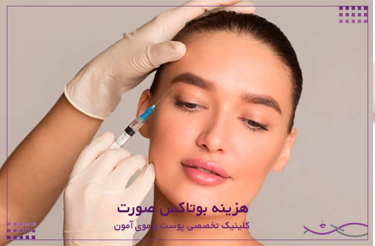 هزینه بوتاکس صورت