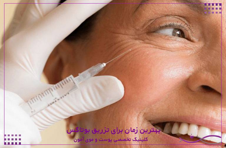 بهترین زمان برای تزریق بوتاکس