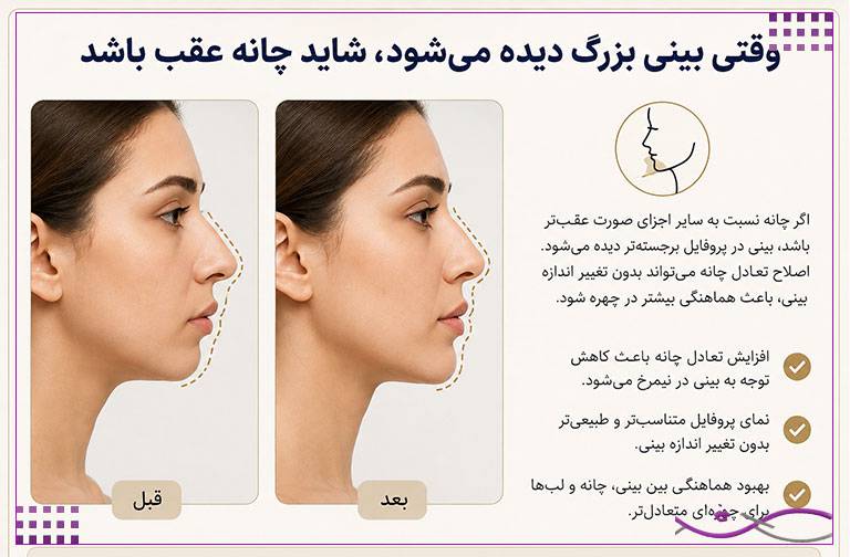 کدام نقطه صورت بیشترین تأثیر را روی تناسب چهره دارد؟ 3 مهمترین نقطه صورت برای همه یکسان نیست