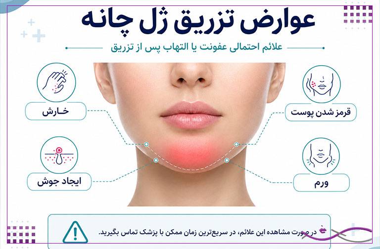 تزریق ژل چانه | هزینه، ماندگاری و عوارض 7 عوارض تزریق ژل چانه