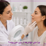 چرا جای جوش‌ها از بین نمی‌روند؟ راهنمای کامل درمان اسکار آکنه