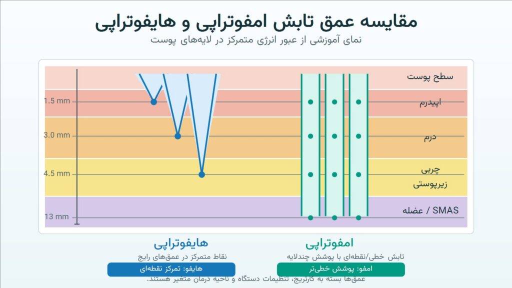 امفوتراپی یا هایفوتراپی؛ تفاوت دو روش لیفت پوست بدون جراحی چیست؟ 3 مقایسه عمق امفوتراپی هایفوتراپی